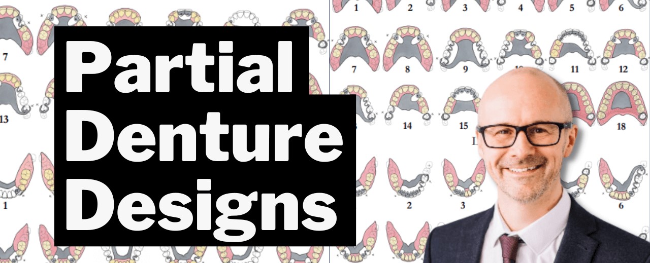 Chrome Partial Dentures Guide The Scandinavian Way PDP134