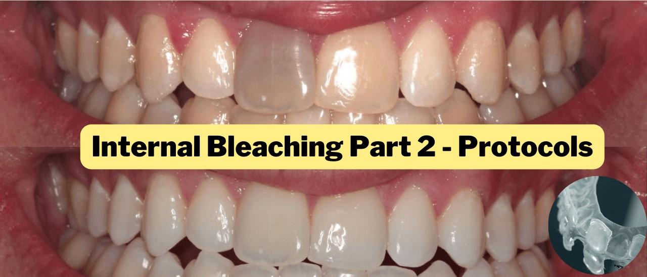 Internal Whitening Protocols Pt2 (Non Vital Bleaching) PDP147