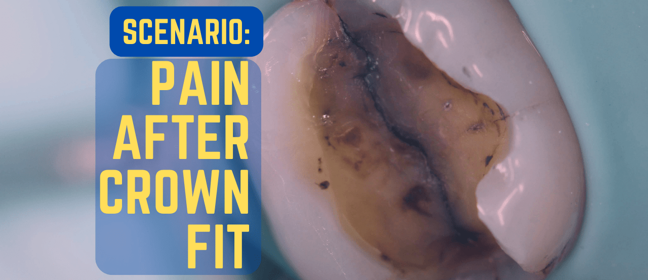 Pain after Crown Fit an Upset Patient! How to Manage Tough Scenarios